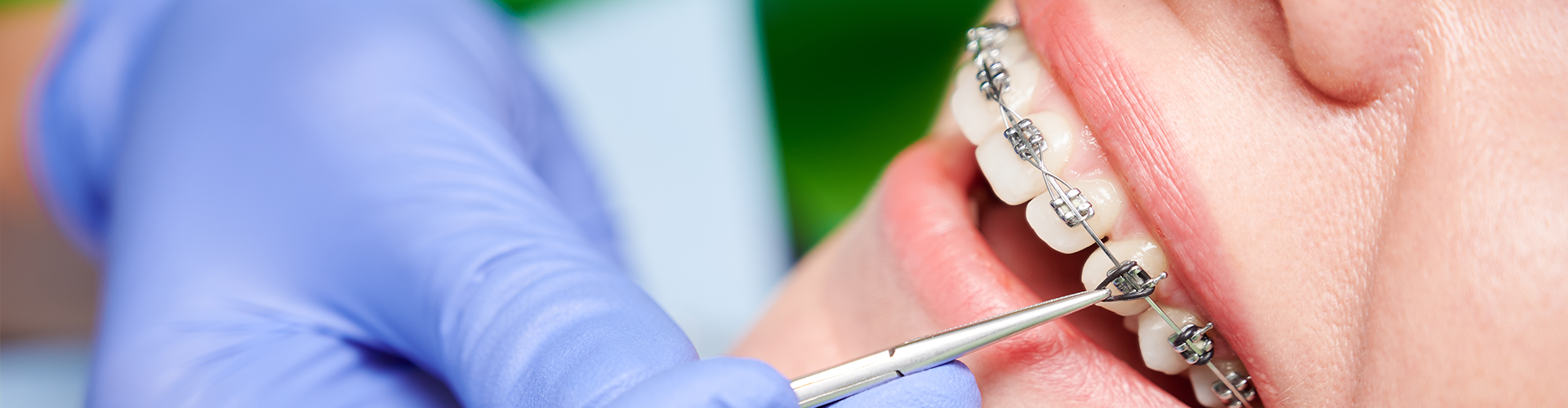 gloved hand using tool on smile with braces