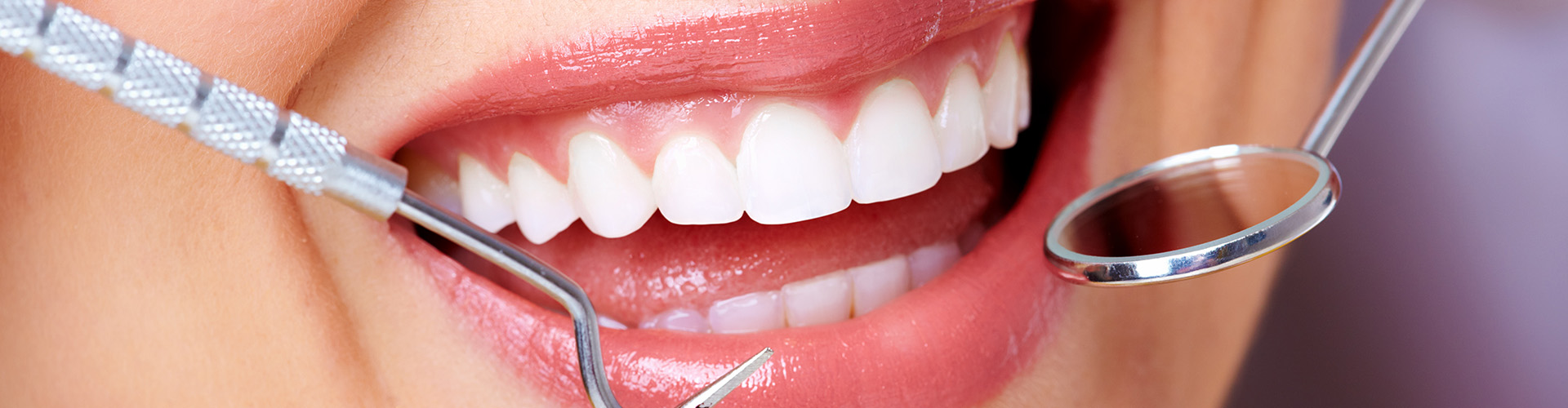 Close-up of a smile surrounded by dental tools.