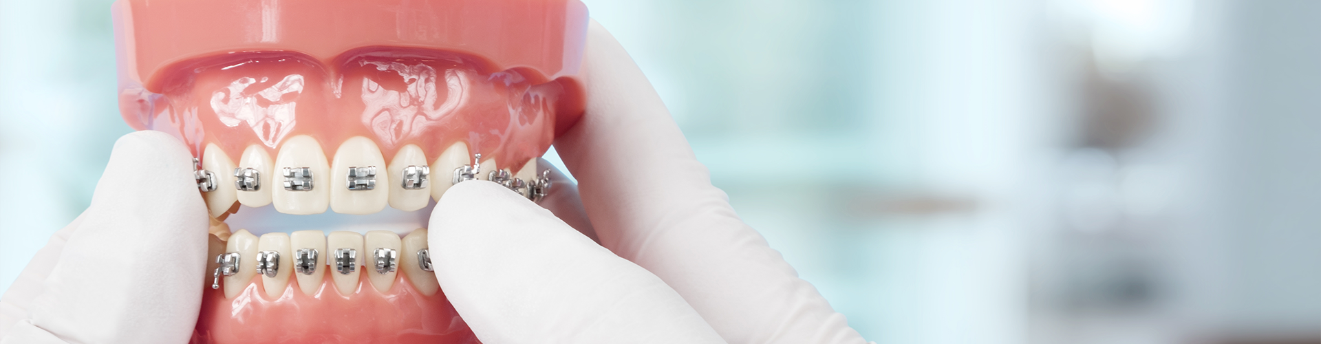 gloved hands holding mouth model with braces