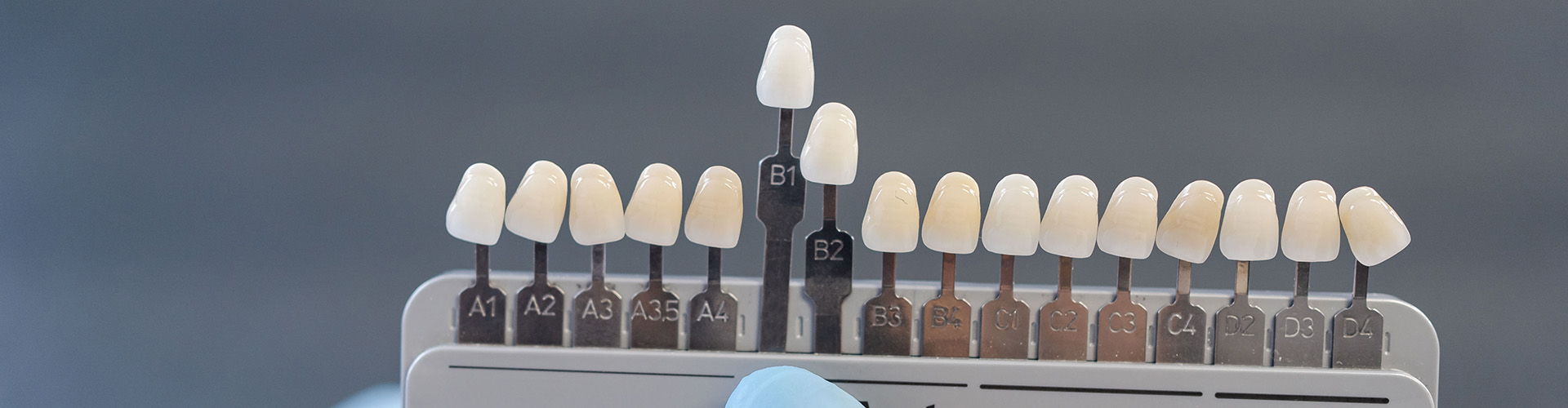 gloved hand holding a tooth shade-matching tool