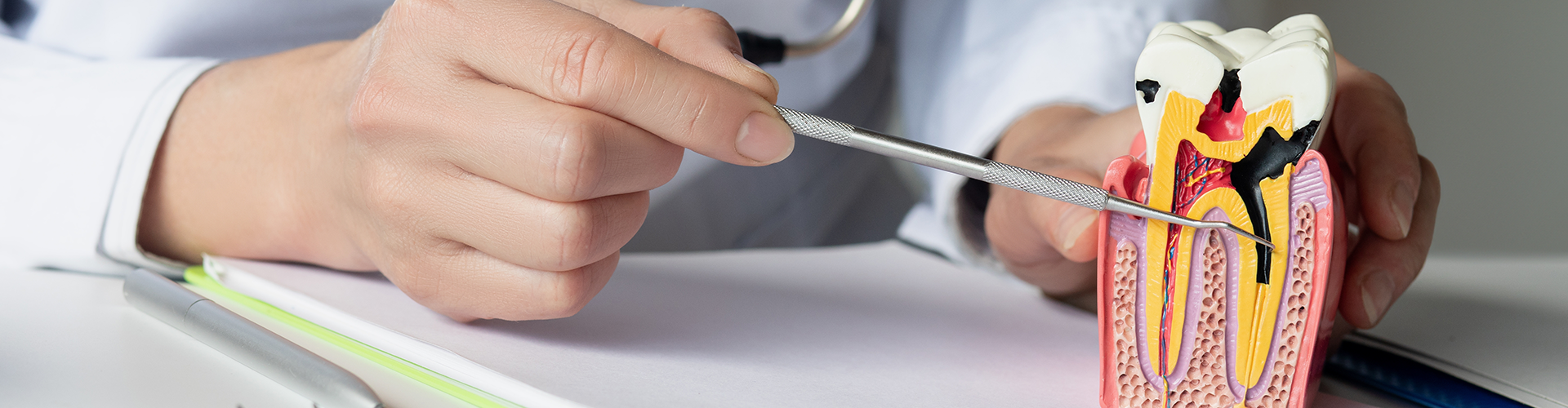 hands holding tooth model showing the anatomy