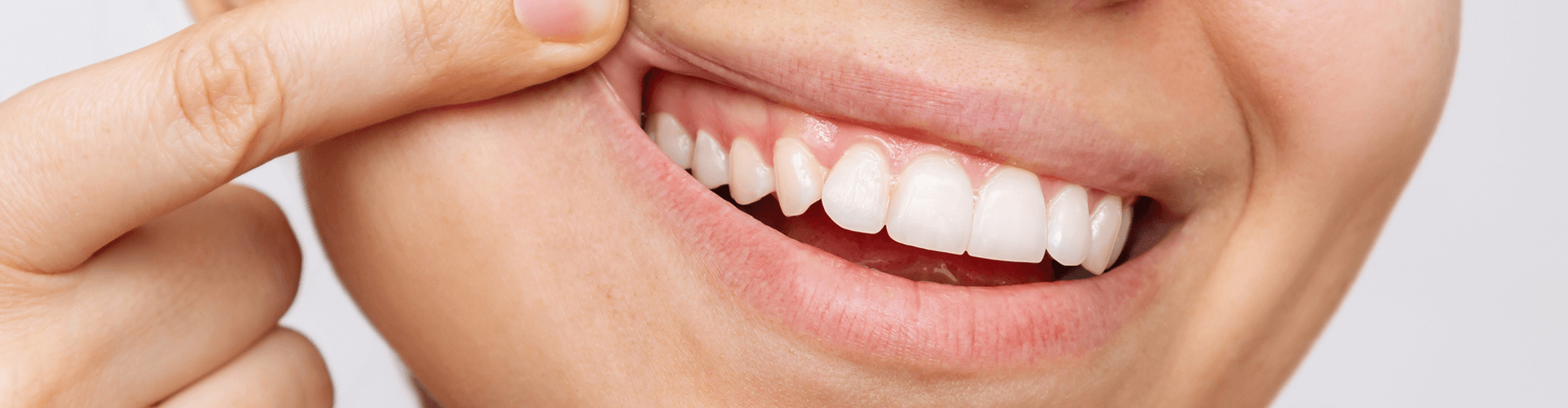 person showing their gums