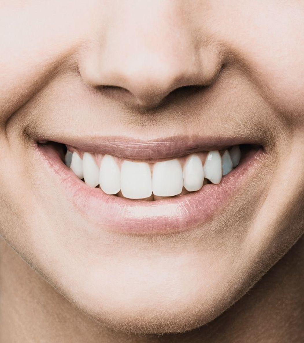 An image of a woman smiling with a great set of teeth