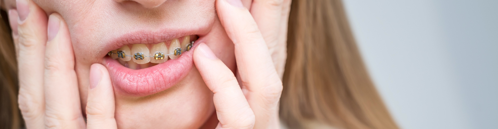 close up of girl with braces holding her cheeks