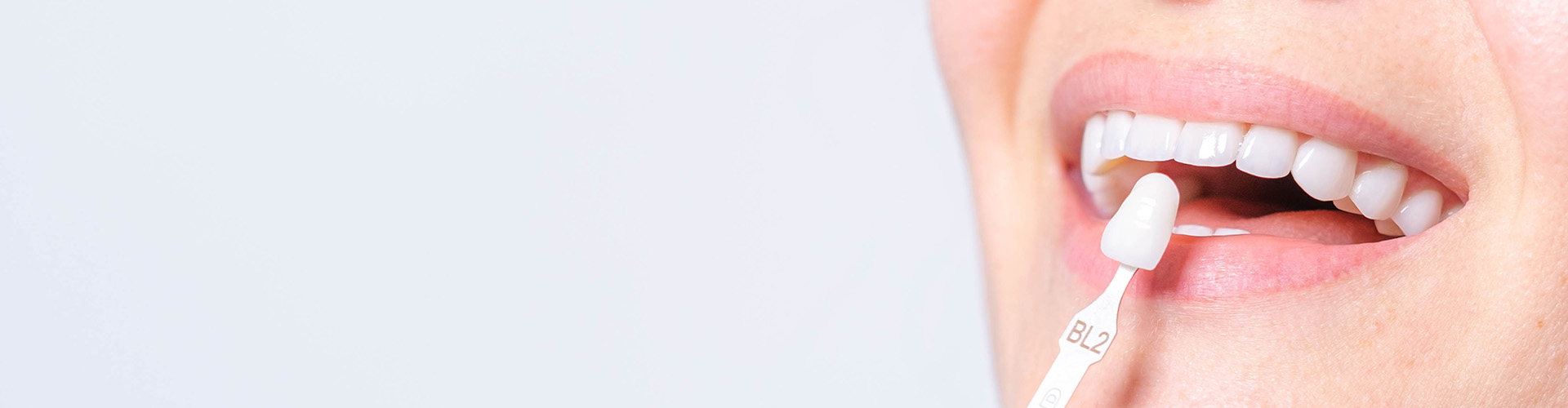 dentist shade-matching a patient's teeth color