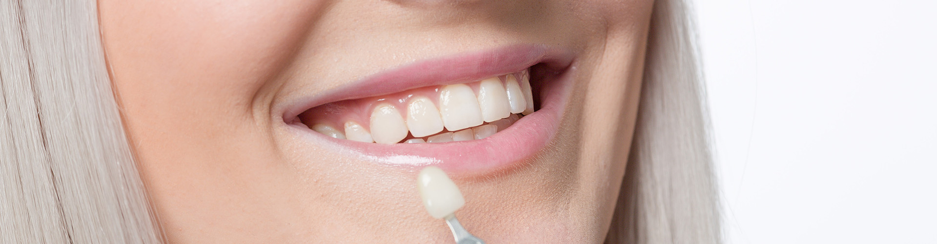 hand holding tooth shade-matching tool beside woman's smile